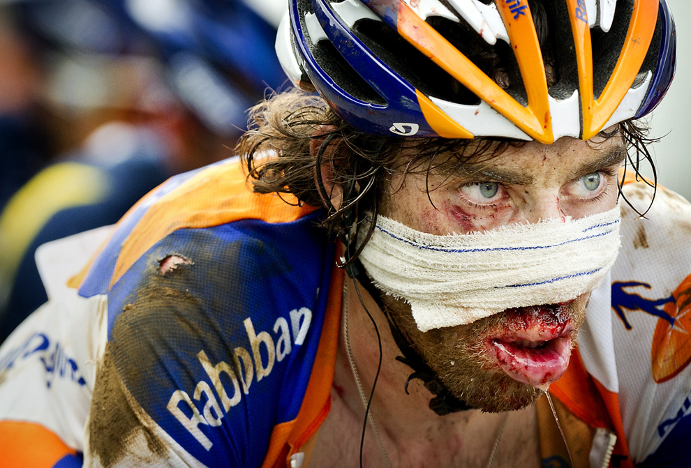 Cyclist with a makeshift bandage over a bloody nose